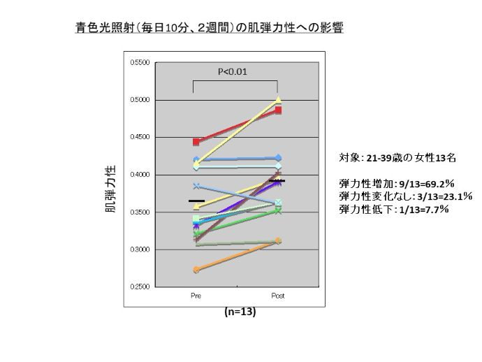 円形脱毛症　病院